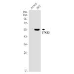 STK33 Recombinant Rabbit Monoclonal Antibody (K01_1Y82)
