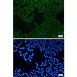 SEC61alpha Recombinant Rabbit Monoclonal Antibody (K01_1Y19)