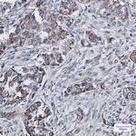 SEC61alpha Antibody in Immunohistochemistry (Paraffin) (IHC (P))