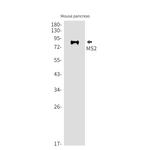ADAM8 Recombinant Rabbit Monoclonal Antibody (K01_1U09)