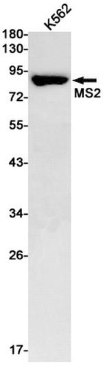 ADAM8 Antibody in Western Blot (WB)