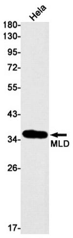 DEGS1 Recombinant Rabbit Monoclonal Antibody (K01_1T94)