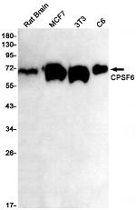 CPSF6 Recombinant Rabbit Monoclonal Antibody (K01_1P79)