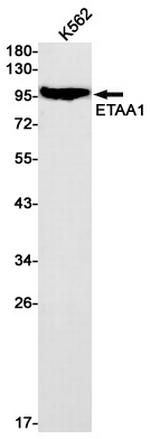 ETAA1 Recombinant Rabbit Monoclonal Antibody (K01_1Q92)