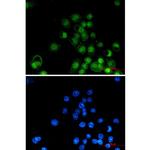 RXRA Recombinant Rabbit Monoclonal Antibody (K01_1X76)