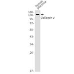 COL6A1 Recombinant Rabbit Monoclonal Antibody (K01_1P71)