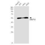 CUG-BP2 Recombinant Rabbit Monoclonal Antibody (K01_1P46)