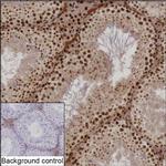 NPM1 Recombinant Rabbit Monoclonal Antibody (K01_1U96)