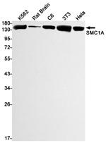 SMC1 Recombinant Rabbit Monoclonal Antibody (K01_1Y54)
