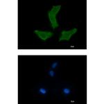NEK9 Recombinant Rabbit Monoclonal Antibody (K01_1U64)