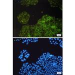 RAP1GAP Recombinant Rabbit Monoclonal Antibody (K01_1X60)