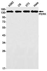 PERK Recombinant Rabbit Monoclonal Antibody (K01_1W59)