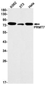 PRMT7 Recombinant Rabbit Monoclonal Antibody (K01_1X12)
