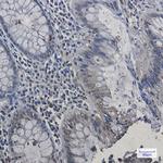 HP1 alpha Antibody in Immunohistochemistry (Paraffin) (IHC (P))