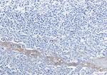 G6PD Recombinant Rabbit Monoclonal Antibody (K01_1R70)