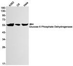 G6PD Antibody in Western Blot (WB)