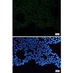 N-WASP Recombinant Rabbit Monoclonal Antibody (K01_1W05)