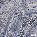 N-WASP Antibody in Immunohistochemistry (Paraffin) (IHC (P))