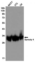 SPRY4 Recombinant Rabbit Monoclonal Antibody (K01_1Y72)