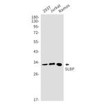 SLBP Recombinant Rabbit Monoclonal Antibody (K01_1Y46)
