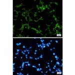 ORP1 Recombinant Rabbit Monoclonal Antibody (K01_1W10)