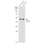 ORP1 Antibody in Western Blot (WB)
