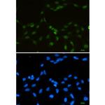 RBMX Recombinant Rabbit Monoclonal Antibody (K01_1S36)