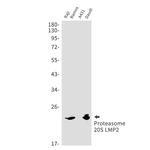 PSMB9 Recombinant Rabbit Monoclonal Antibody (K01_1X17)