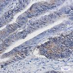 DGAT1 Recombinant Rabbit Monoclonal Antibody (K01_1Q38)