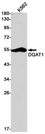 DGAT1 Antibody in Western Blot (WB)