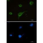 Syntrophin alpha-1 Recombinant Rabbit Monoclonal Antibody (K01_1Y97)