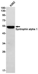 Syntrophin alpha-1 Antibody in Western Blot (WB)