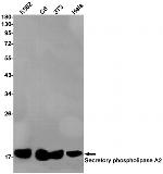 PLA2G2A Recombinant Rabbit Monoclonal Antibody (K01_1Y20)