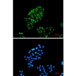 Cytokeratin 18 Recombinant Rabbit Monoclonal Antibody (K01_1Q16)