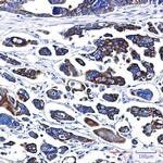 Cytokeratin 18 Antibody in Immunohistochemistry (Paraffin) (IHC (P))