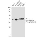Phospho-PARVA (Ser8) Recombinant Rabbit Monoclonal Antibody (K01_1W38)