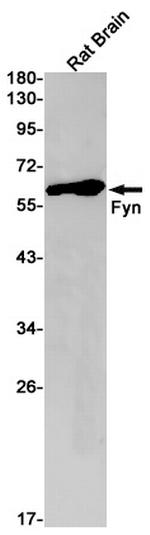 Fyn Antibody in Western Blot (WB)