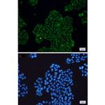 CLIC4 Recombinant Rabbit Monoclonal Antibody (K01_1P63)