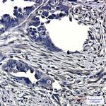CLIC4 Antibody in Immunohistochemistry (Paraffin) (IHC (P))