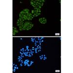 TEC Recombinant Rabbit Monoclonal Antibody (K01_2J21)