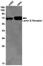 Lamin B Receptor Antibody in Western Blot (WB)