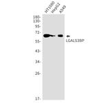 LGALS3BP Recombinant Rabbit Monoclonal Antibody (K01_1T47)