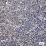 Phospho-c-Raf (Ser259) Recombinant Rabbit Monoclonal Antibody (K01_1X52)