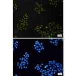 CGBP Recombinant Rabbit Monoclonal Antibody (K01_1P50)