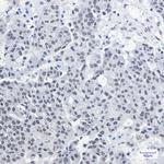 CGBP Antibody in Immunohistochemistry (Paraffin) (IHC (P))