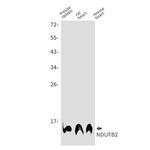 NDUFB2 Recombinant Rabbit Monoclonal Antibody (K01_1U53)
