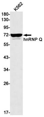 HnRNP Q Antibody in Western Blot (WB)