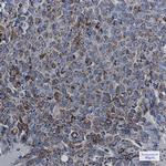 MDH2 Recombinant Rabbit Monoclonal Antibody (K01_1T73)