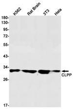 CLPP Recombinant Rabbit Monoclonal Antibody (K01_1P64)