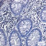 Phospho-GYS1 (Ser641) Recombinant Rabbit Monoclonal Antibody (K01_1R81)